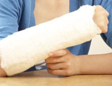 Injured arm in a cast
